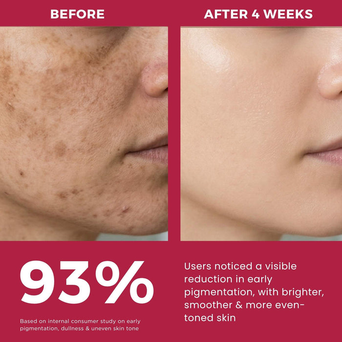 Dull & Uneven Skin Tone - 3 Step with Facewash+10% Vitamin C Face Serum+Sunscreen SPF50 - The Skin Story -