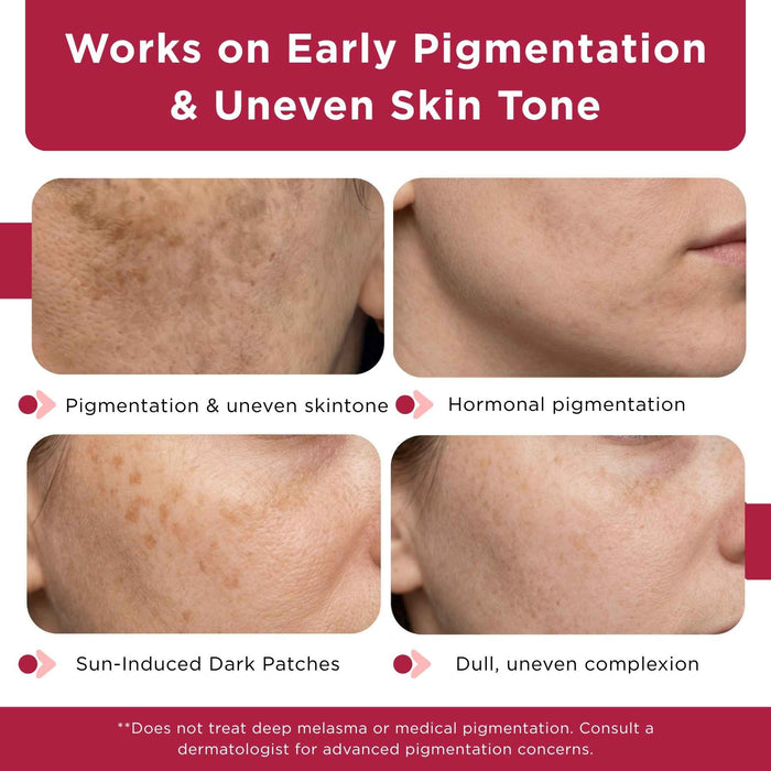 Dull & Uneven Skin Tone - 3 Step with Facewash+10% Vitamin C Face Serum+Sunscreen SPF50 - The Skin Story -