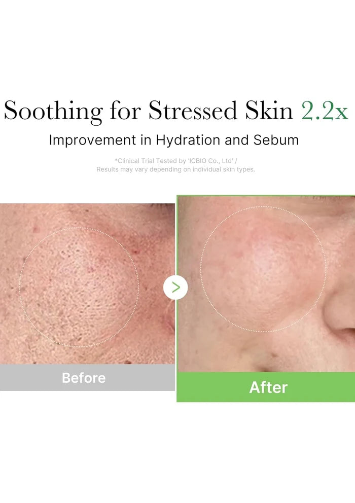 Before and after comparison of skin with text 'Soothing for Stressed Skin 2.2x' on a white background.