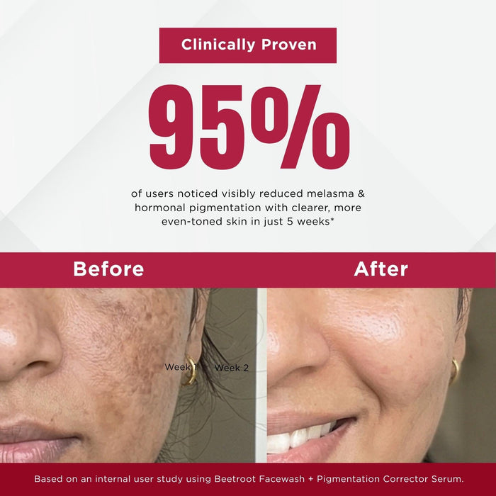 Melesma 3 Steps - Facewash+Serums - The Skin Story -